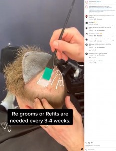 地肌と接するヘアシステムのベースには通気性フィルムが付いており、特殊な接着剤で直接貼り付ける。一度装着すると3～4週間毎に1回、サロンで1時間ほどのメンテナンスが必要とのことだ（画像は『Novo Cabelo　2023年3月20日付Instagram「REGROOMS/REFITS EXPLAINED」』のスクリーンショット）