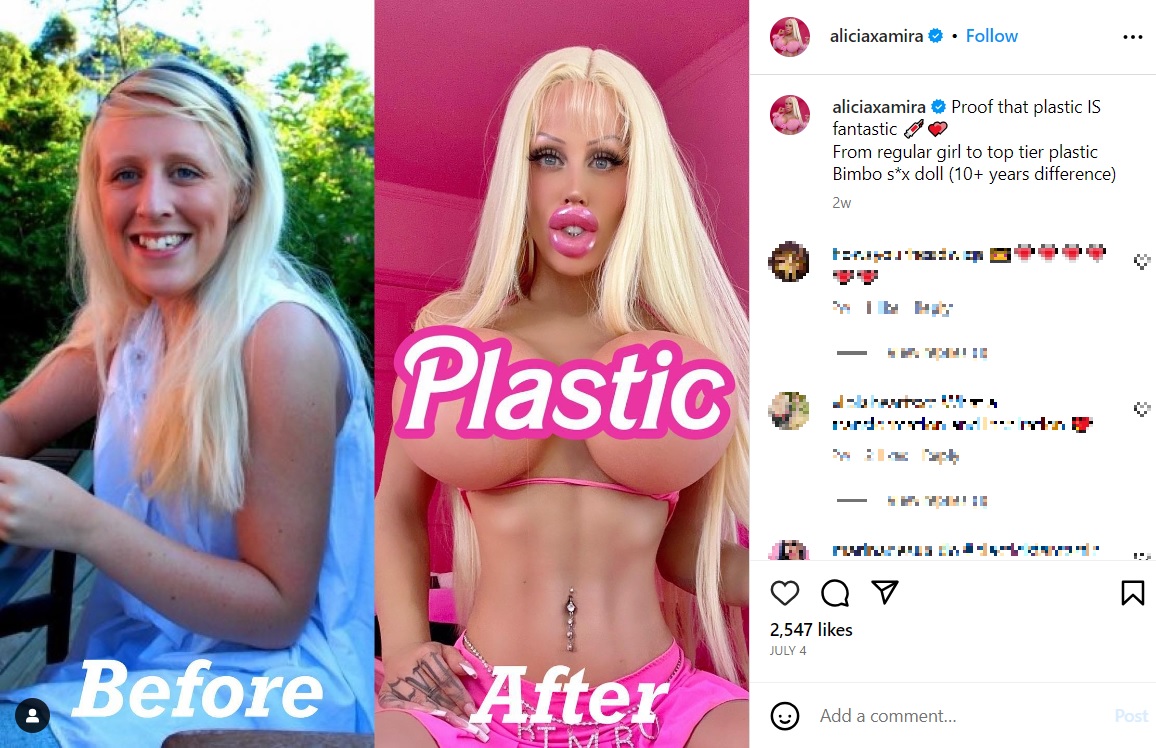 世界一「人形のような整形美女」になりたいというアリシアさんが、10年かけて受けてきた整形手術のビフォーアフター写真を公開した（画像は『Alicia Amira　2023年7月4日付Instagram「Proof that plastic IS fantastic」』のスクリーンショット）