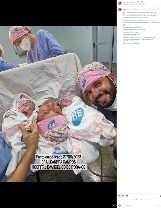 ブラジル、ゴイアス州イポラのエヴァンジェーリコ病院（Hospital Evangélico）で先月27日、双子姉妹が誕生した。そのうちの1人は卵膜と羊水に包まれた被膜児だった（画像は『Dra. Leandra Campos Barbosa　2023年6月28日付Instagram「Fala aí se eu sou a rainha dos empelicados?」』のスクリーンショット）