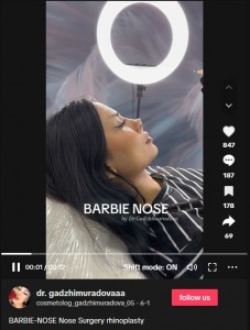 オズデミル医師のSNSに投稿された動画の一部。横から見ると確かに鼻がツンとしていて、鼻腔が上を向いているような感じさえする（画像は『cosmetolog_gadzhimuradova_05　2023年6月1日付TikTok「BARBIE-NOSE Nose Surgery rhinoplasty」』のスクリーンショット）