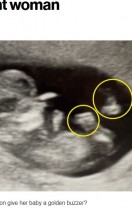 【海外発！Breaking News】超音波検査の画像に映り込んだのは大好きな“セレブ”2人！　妊婦驚愕（米）