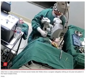 貴港愛爾眼科医院の院長でもあるフォン・グイチャン氏（馮 桂強）が、手術中の女性の頭を数回拳で殴る様子が動画に捉えられていた（画像は『New York Post　2023年12月22日付「Video of Chinese doctor punching elderly patient in head during surgery sparks outrage」（Weibo）』のスクリーンショット）