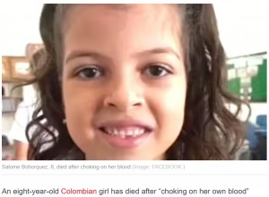 コロンビアの歯科医院で今年8月、8歳女児が抜糸した後に亡くなる。母親は「出血した自分の血で窒息してしまった」と主張していた（画像は『Express.co.uk　2023年8月11日付「Girl ‘choked on her own blood’ and died after suffering a gushing haemorrhage at dentist」（Image: FACEBOOK）』のスクリーンショット）