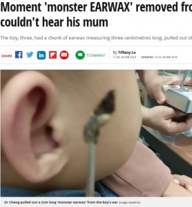 台湾在住のある母親が2019年、3歳の息子を連れて病院に駆け込んだ。名前を呼んでも応じなくなった息子を心配したが、大量の耳垢が詰まっていただけだった（画像は『Mirror　2019年2月28日付「Moment ‘monster EARWAX’ removed from toddler who couldn’t hear his mum」（Image: AsiaWire）』のスクリーンショット）