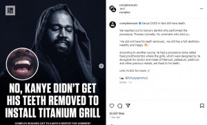 米音楽メディア『Complex Music』の投稿。コネリー医師は「カニエは抜歯していない」と語ったという（画像は『Complex Music　2024年1月18日付Instagram「Kanye DOES in fact still have teeth.」』のスクリーンショット）