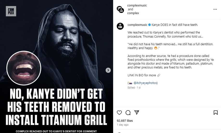 米音楽メディア『Complex Music』の投稿。コネリー医師は「カニエは抜歯していない」と語ったという（画像は『Complex Music　2024年1月18日付Instagram「Kanye DOES in fact still have teeth.」』のスクリーンショット）
