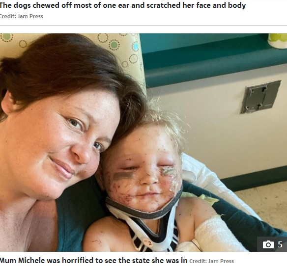 米カリフォルニア州で2022年6月、生後12週の子犬4匹に2歳の女児が襲われた。女児は耳がちぎれ、重傷を負った（画像は『The Sun US　2022年6月14日付「PUPPY MAULING My little girl, 2, was mutilated and almost eaten alive by our PUPPIES in horror attack ― I blamed myself」（Credit: Jam Press）』のスクリーンショット）