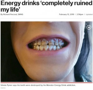 モンスターエナジーを一日6本飲んでいたという英ケント州在住の男性。歯科医に「これまで診た中で最も酷い」と言われ、2018年9月から歯の治療に専念していた（『New York Post　「Energy drinks ‘completely ruined my life’」（SWNS）』より）