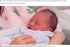 中国湖北省の病院で2020年7月に誕生した男児。へその緒が首に6回も巻き付いていたものの、他に異常が見られなかったという（『Mirror　「Medical miracle as baby born with umbilical cord wrapped six times around neck survives」（Image: Real Press）』より）