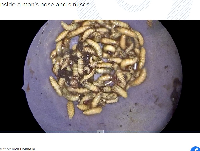 摘出された幼虫150匹は種類を特定するため疫学者のもとに送られた。そしてこのニュースには「これまで聞いた中でトップ10に入るほどおぞましいニュースだった」という声もあがった（『First Coast News　「150 live bugs removed from inside of man’s face at Jacksonville hospital」』より）