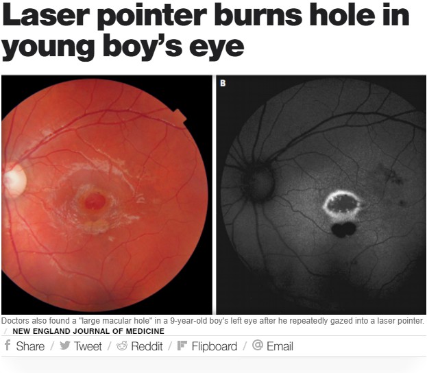2018年6月、医学雑誌「ニューイングランド・ジャーナル・オブ・メディシン」でギリシャの9歳男児の左目に黄斑円孔が確認されたことが症例として発表された。男児はレーザーポインターで遊んでいたという（『CBS News　「Laser pointer burns hole in young boy’s eye」（NEW ENGLAND JOURNAL OF MEDICINE）』より）