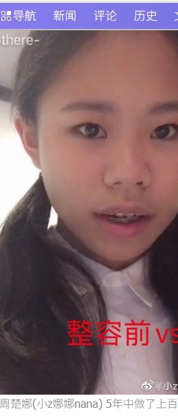 13歳からの5年間で約400万元（約8340万円）を整形手術に費やしてきた中国の女性。写真は整形前で、常に自身の外見にコンプレックスを抱いてきたという（『希望之声　「中国网红跃升为女星 整型上百次频换身分证」（图片: 小z娜娜nana 微博）』より）