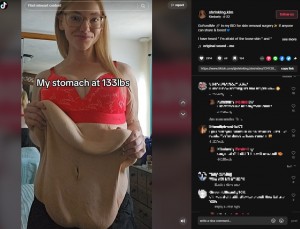 2年で約80キロ痩せた米ペンシルベニア州在住の女性。TikTokでありのままの姿を晒して多くの人をインスパイアしていた（『Kimberly　TikTok「GoFundMe」』より）