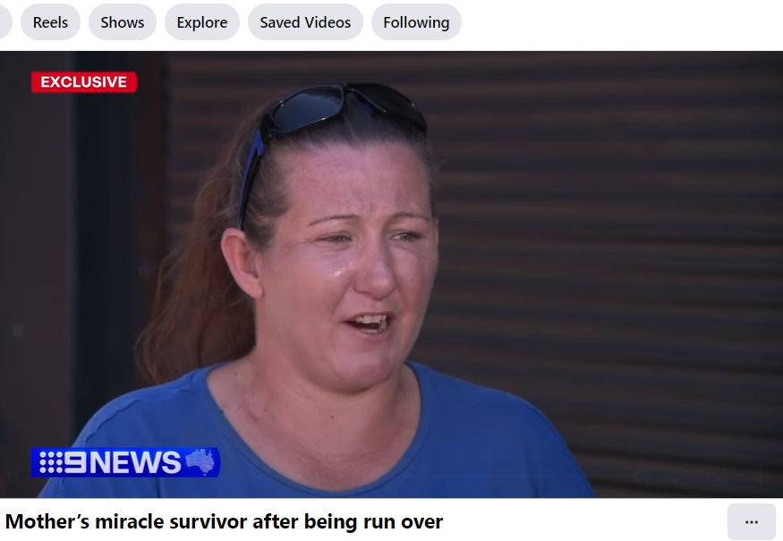 オーストラリア、西オーストラリア州で先月10日夜、路地に座り込んでいてピックアップトラックにひかれた女性。奇跡的に命を取り留めた（『9 News　Facebook「Mother’s miracle survivor after being run over」』より）
