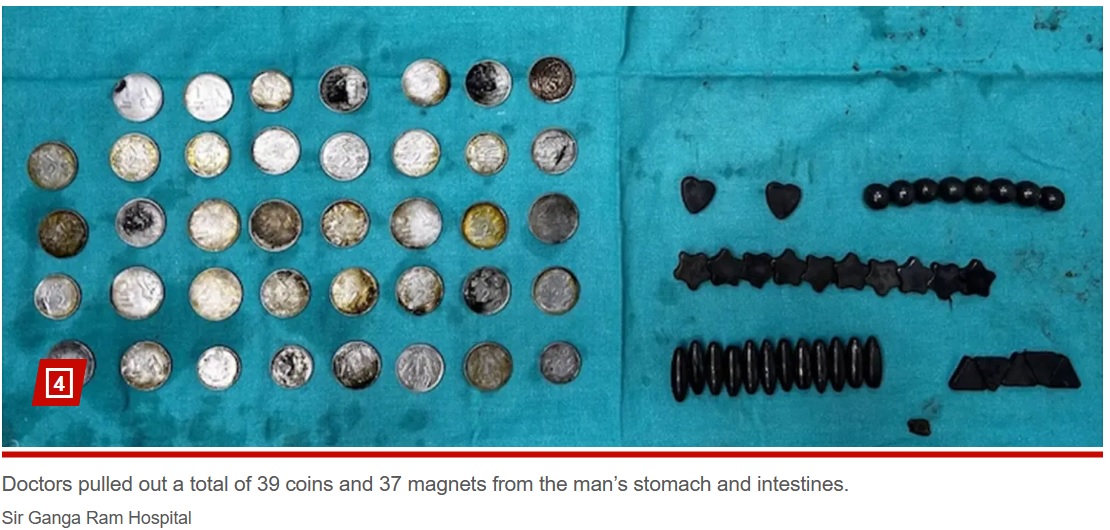 男性の胃や腸からは、39枚の硬貨と37個の磁石が摘出された。男性は精神疾患の治療を受けており、正常な判断ができなかったようだ（『New York Post　「Weightlifter ate 39 coins, 37 magnets because he thought ‘zinc helps in bodybuilding’: report」（Sir Ganga Ram Hospital）』より）