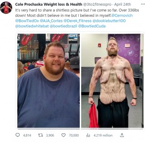 手術せず2年で152キロ減量した米サウスカロライナ州在住の男性。溶けたようなたるんだ皮膚を披露していた（『Cole Prochaska Weight loss ＆ Health　X「It’s very hard to share a shirtless picture」』より）