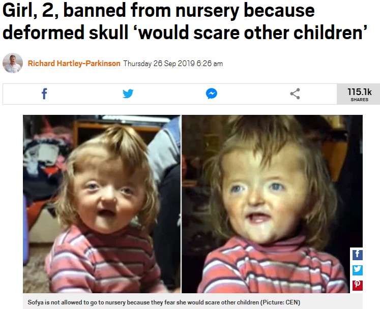 ロシア連邦に属するバシコルトスタン共和国で2019年、2歳女児が保育園への入園を拒否された。女児は頭蓋骨が変形しており、「他の子が怖がるから」という理由だった（『Metro　「Girl, 2, banned from nursery because deformed skull ‘would scare other children’」（Picture: CEN）』より）