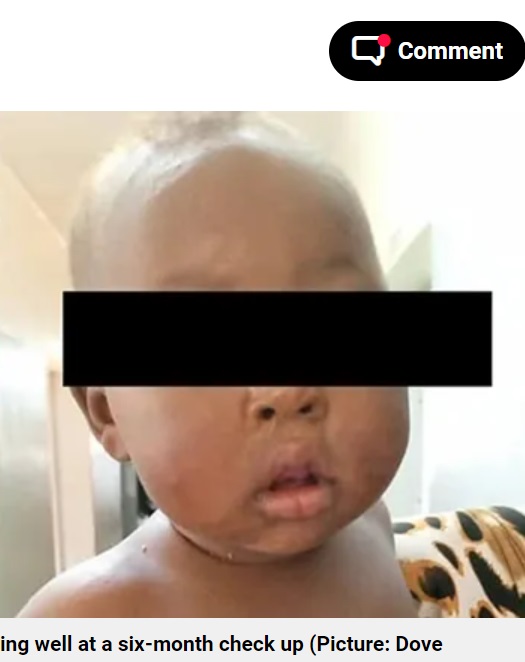 ウガンダで23歳の母親に生き埋めにされた女児。写真は救出されてから6か月後に撮影されたもので、健康状態は良好という（『Metro.co.uk　「Newborn baby miraculously survives after mum, 23, buried her alive」（Picture: Dove Medical Press Limited）』より）