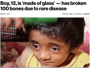 骨形成不全症を患う印ウッタル・プラデーシュ州在住の少年。2022年当時12歳だったが、これまでに100か所以上は骨折してきたという（『New York Post　「Boy, 12, is ‘made of glass’ ― has broken 100 bones due to rare disease」（Jam Press Vid/Rare Shot News）』より）
