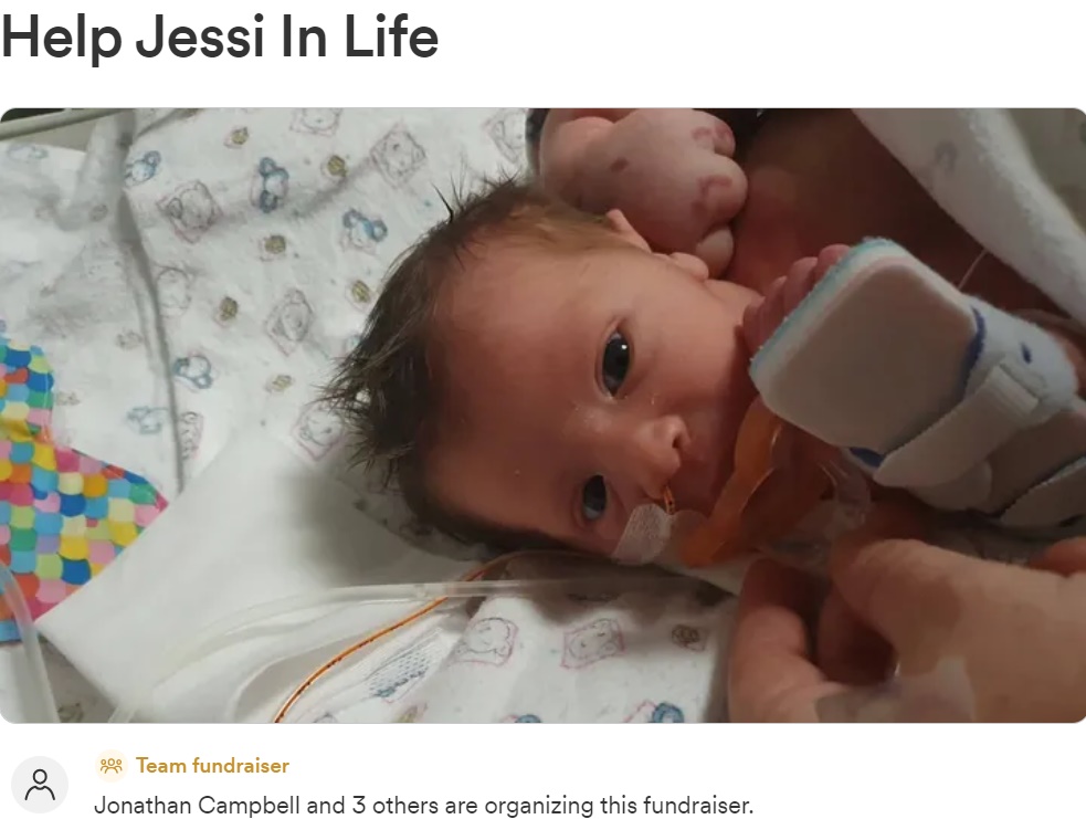 2021年8月28日、豪クイーンズランド州ブリスベンで誕生したジェシーちゃん。左側上半身が肥大し、腕がパイナップルと同じくらいの大きさだった（『GoFundMe　「Help Jessi In Life」』より）