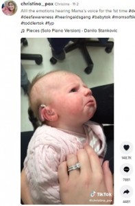 2020年11月、生後5週間で初めて補聴器をつけた赤ちゃん。ママの声を聞いて、泣きそうになったり笑ってみたりと様々な感情が交錯しているようだった（『Christina　TikTok「Allll the emotions hearing Mama’s voice for the 1st time」』より）
