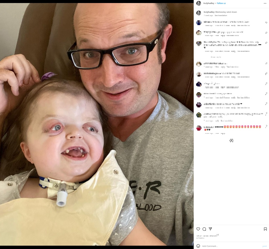 米フロリダ州で2016年6月に誕生した女児は、頭蓋縫合の早期癒合によって頭蓋骨や顔面の異常を引き起こす難病「ファイファー症候群」を患っている。彼女の両親が2022年、これまでの葛藤、苦しみ、喜び、そして娘への愛について語っていた（『Hadley　Instagram「Wednesday wind down」』より）