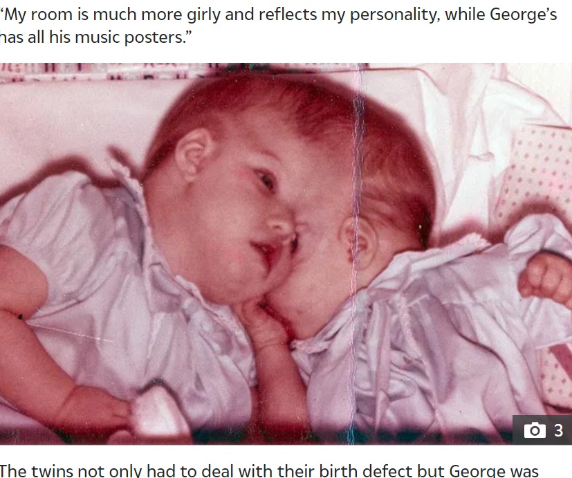 2人が誕生した時代、分離手術という選択肢はなかった。しかしながら、1997年のドキュメンタリーで2人は「分離を望んだことはない」と明言していた（『The Sun　「JOINED AT THE HEAD Conjoined twins George and Lori Schappell: “We have normal lives”」』より）