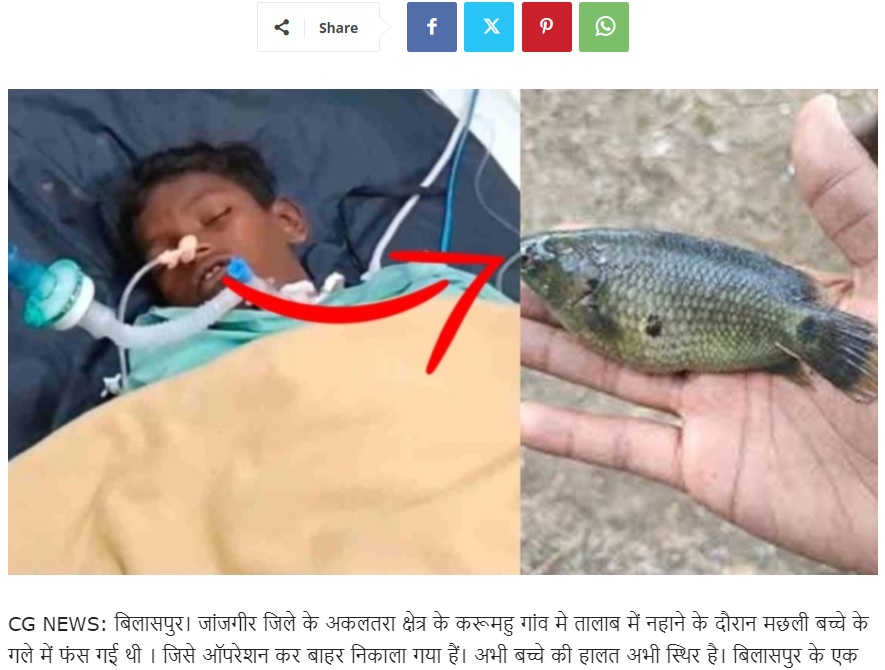 インド、チャッティースガル州ジャーンジギールチャーンパ地区アカルタラのある村で先月29日朝、池で泳いでいて魚が口に飛び込んできたというサミール君。手術を受けて入院した（『Public News Chhattisgarh　「बच्चे के गले में फंसी मछली को डॉक्टरों ने ऑपरेशन कर निकाला बाहर, बच्चे की हालत अभी स्थिर !」』より）