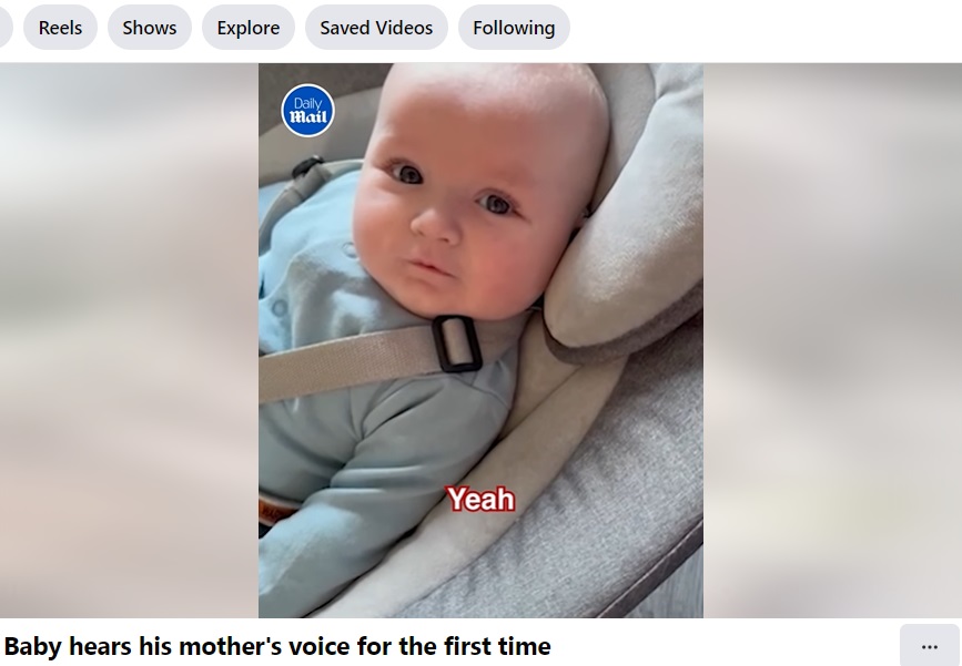 英ウェスト・ヨークシャー、リバーズエッジに住むエイミーさんとマシューさんの三男アルビー・コリンズ君。新生児聴覚スクリーニング検査でひっかかり、専門医を紹介されたという（『Daily Mail Video　Facebook「Baby hears his mother’s voice for the first time」』より）