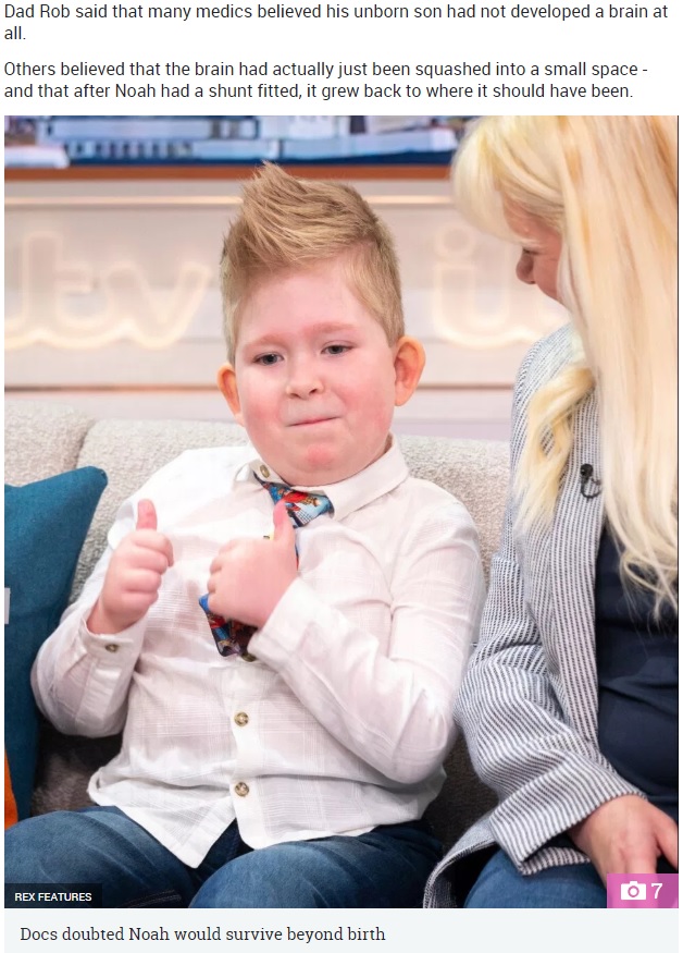 脳が2％しかない状態で生まれたイギリスの6歳男児が2019年、英情報番組に出演。3歳になる頃には、脳が全体の80パーセントまで成長したという（『The Sun　「THE BOY WITH ‘NO BRAIN’ Boy born with MISSING brain defies huge odds to live - after ‘it GREW back’」（Credit: REX FEATURES）』より）