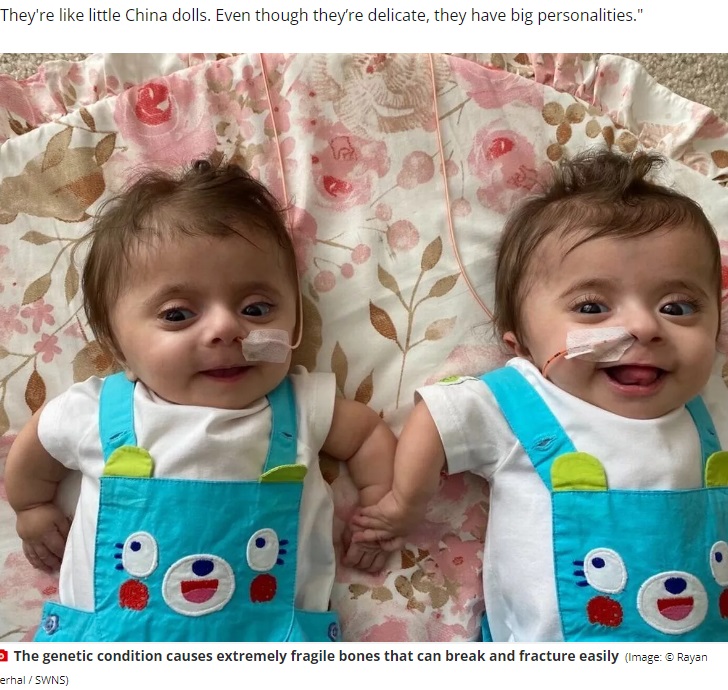 骨が卵の殻のようにもろく、軽く触れたり、クシャミをしたり、ハグをしただけでも骨折してしまう重度の骨形成不全症を患い誕生した双子姉妹。今年8月に4歳を迎える（『WalesOnline　「Twins born with dozens of fractures on their bodies diagnosed with extremely rare condition」（Image: Rayan Serhal / SWNS）』より）