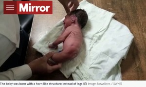 印マディヤプラデーシュ州で2022年8月、腰から角が突き出したような未発達の脚が生えた赤ちゃんが誕生していた（『The Mirror　「Doctors stunned after a baby is born with a horn-like structure instead of legs」（Image: Newslions / SWNS）』より）