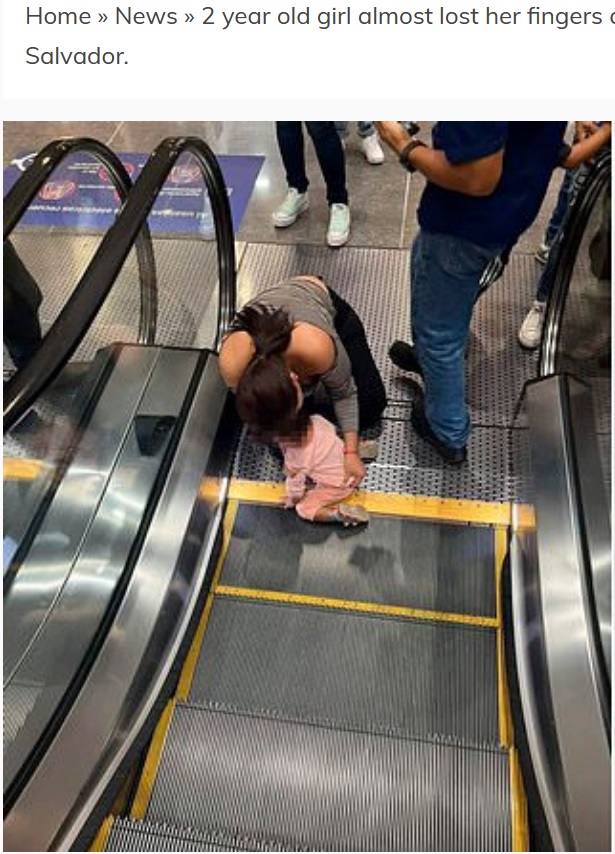 エルサルバドルのショッピングモールで2023年9月、2歳女児がエスカレーターに指を挟まれる。女児はすぐに病院で手術を受け、幸いにも指の切断を免れていた（『TDPel Media　「2 year old girl almost lost her fingers after getting them stuck at a mall escalator in El Salvador.」』より）
