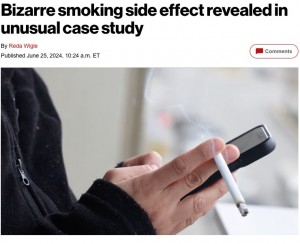 【海外発！Breaking News】タバコの吸いすぎが原因か　気管内に長さ5センチの毛が生えた男性（オーストリア）