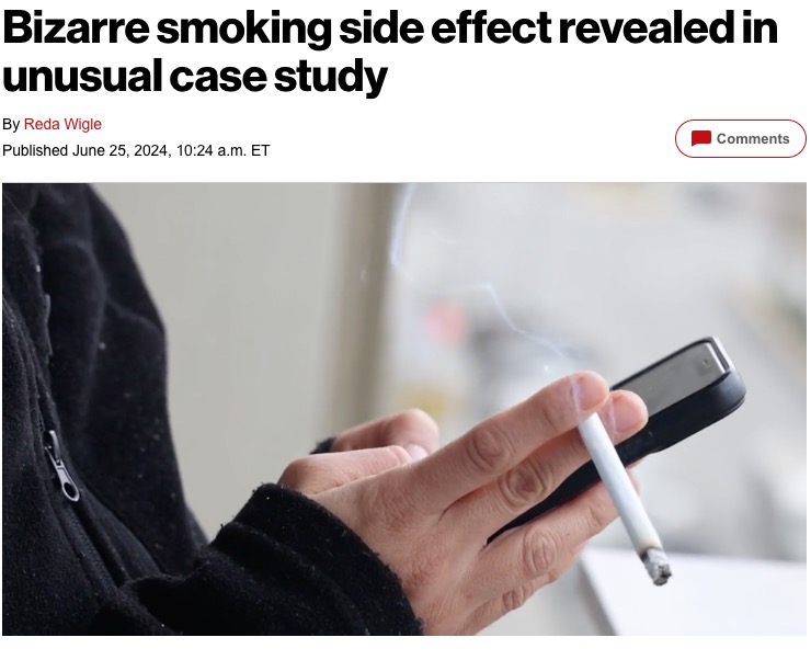 52歳男性の気管内に毛が生える症例が注目を集めている。男性を治療した医療チームは喫煙が原因とみているようだ（『New York Post　「Bizarre smoking side effect revealed in unusual case study」（American Journal of Case Reports）』より）