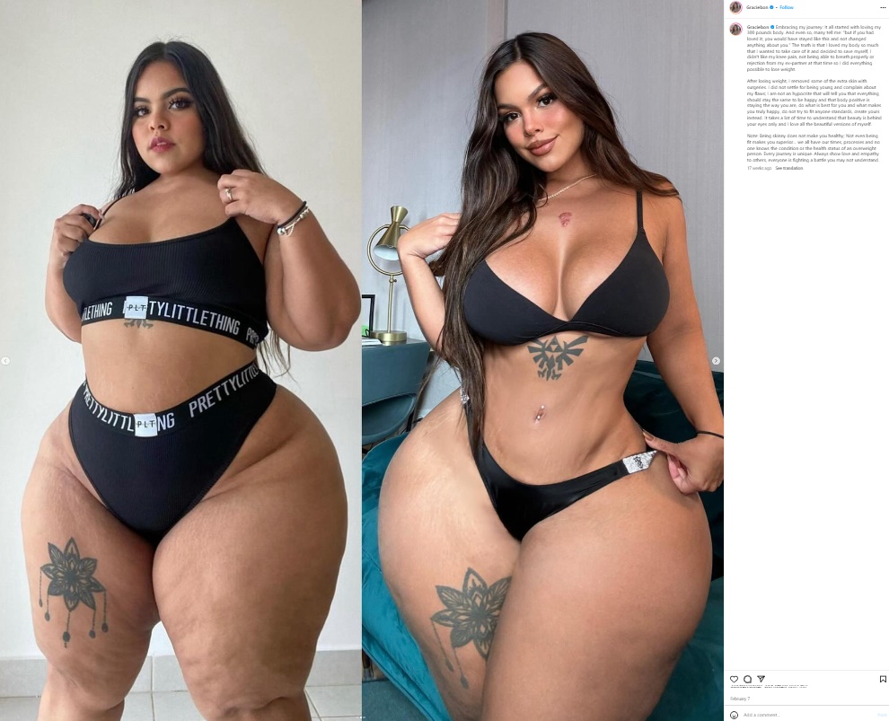 2月に投稿したビフォーアフターの写真。以前は体重が約136キロあったものの（左）、元パートナーに拒絶されて減量したというグレイシーさん。「脂肪吸引とブラジリアンバットリフトを受けたのでは？」といった声もあがっている（『GRACIE BON　Instagram「Embracing my journey」』より）