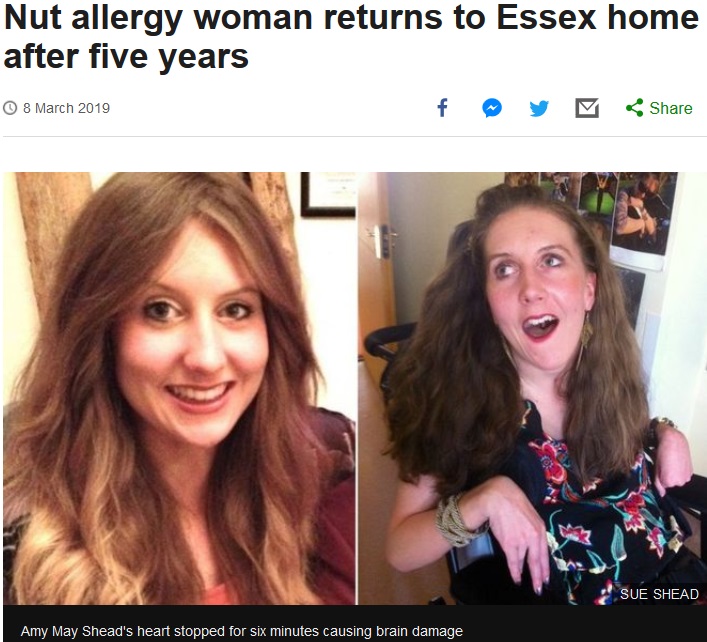 2014年に旅先でアナフィラキシーショック症状に陥った重度のナッツアレルギーを抱える女性。2019年に病院と介護施設を出て、5年ぶりに両親の住む家に戻ったという（『BBC News　「Nut allergy woman returns to Essex home after five years」（SUE SHEAD）』より）
