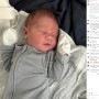 【海外発！Breaking News】「大きなコブ？」いびつな形の頭で誕生した赤ちゃん、24時間以内の変化に驚愕（米）